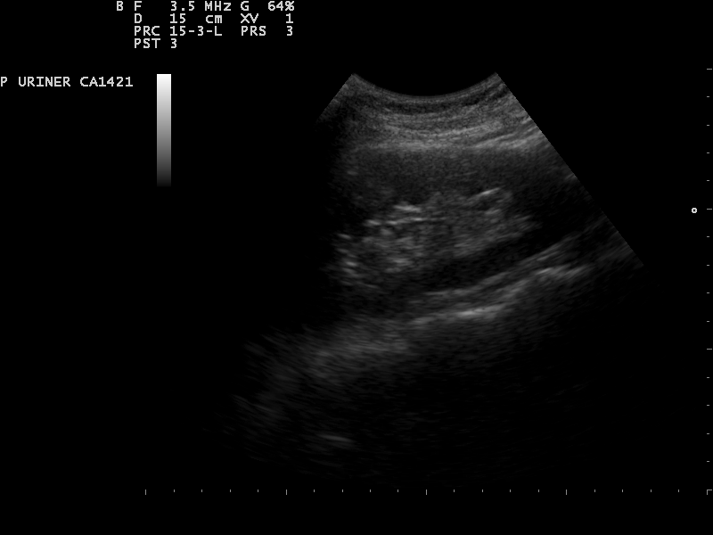 File:Ultrasound Scan ND 0113145215 1453161.png