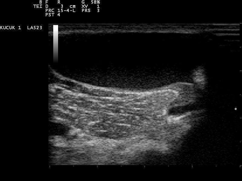 File:Ultrasound Scan ND 110131132845 1334330.jpg