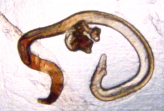 File:Nematode-estomac-hemitriptere.jpg