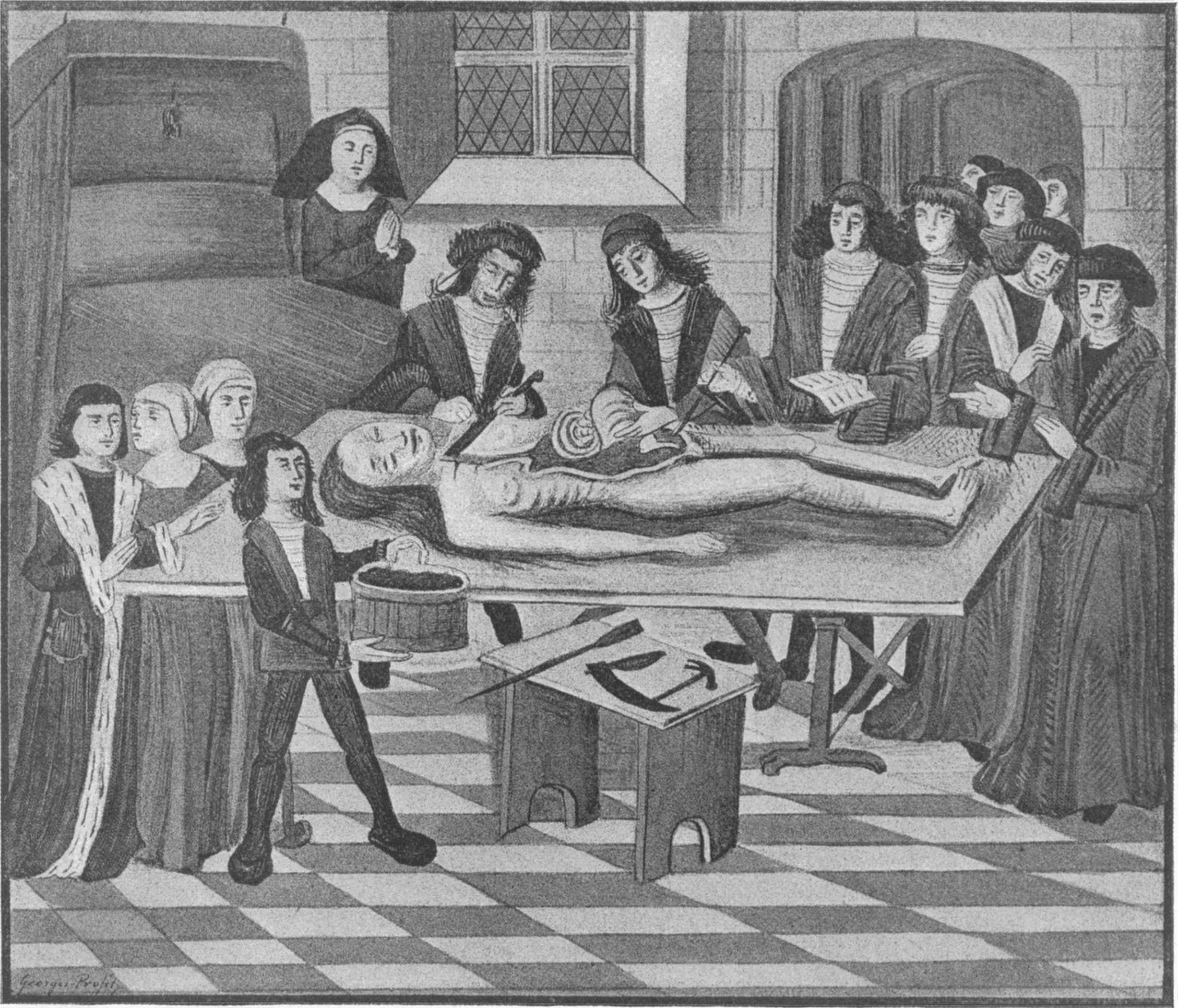 Развитие хирургии в средние века. Мондино де Луцци анатомия. Мондино де Луцци вскрытие. Мондино де Луцци картина.