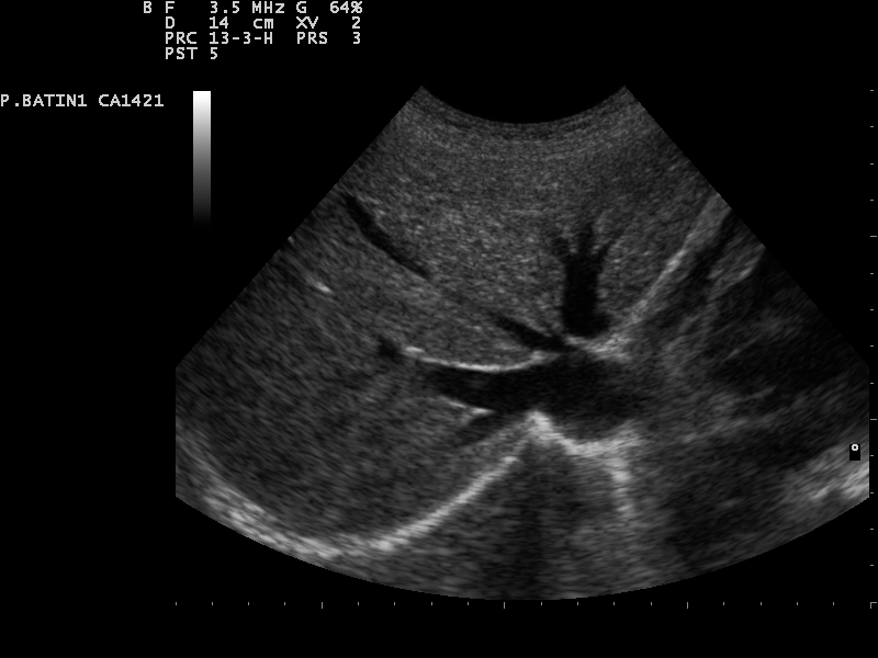 File:Ultrasound Scan ND 0128141905 1420450.png