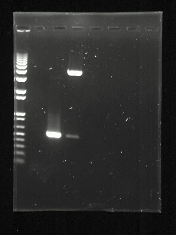 Gel Electrophoresis Of Nucleic Acids Wikiwand