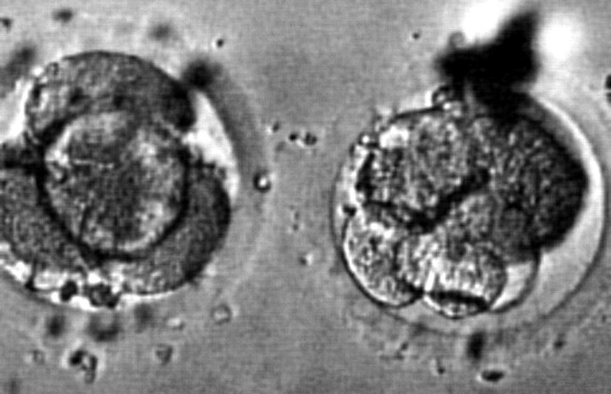 Zwei befruchtete menschliche Eizellen 
