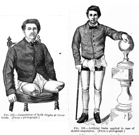 File:MSHWR - Artificial legs 2.png