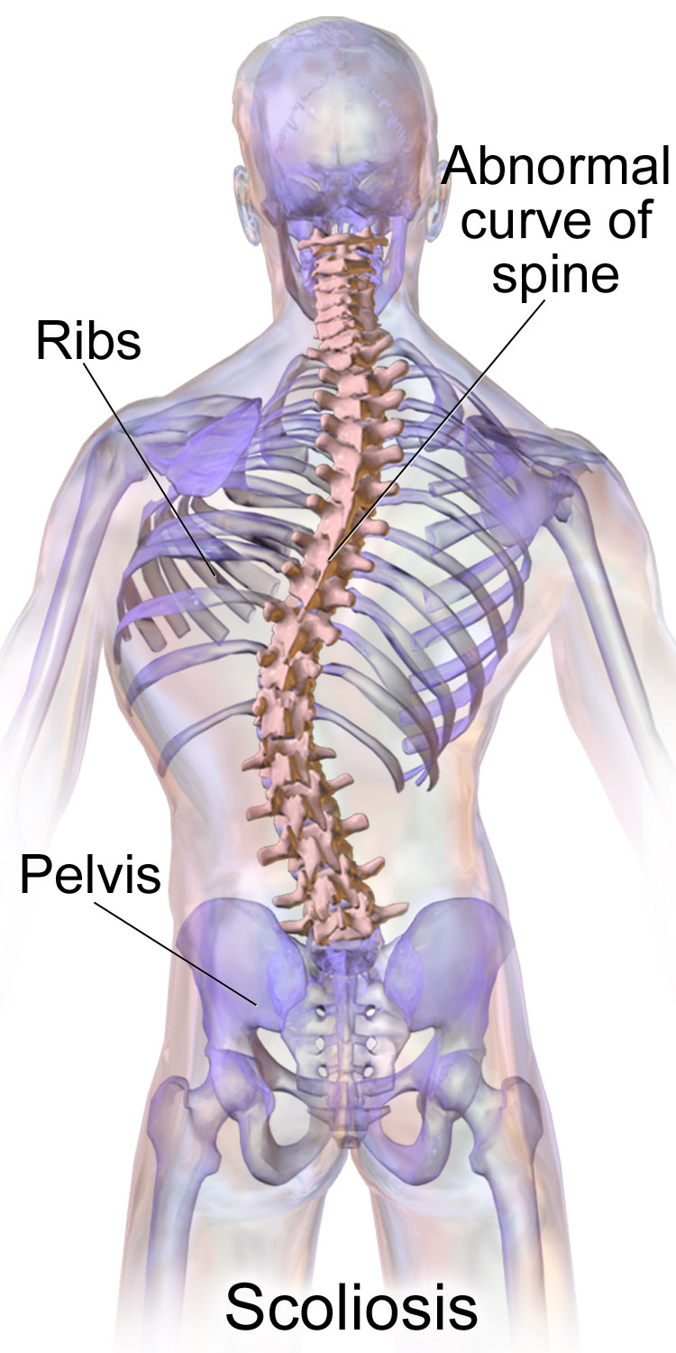 Rear View Of A Woman With Lower Back Pain Clutching Her Hands To Her Back  And Spine To Relieve The Ache In Her Muscles Or Spinal Vertebrae And Discs  Brought On By