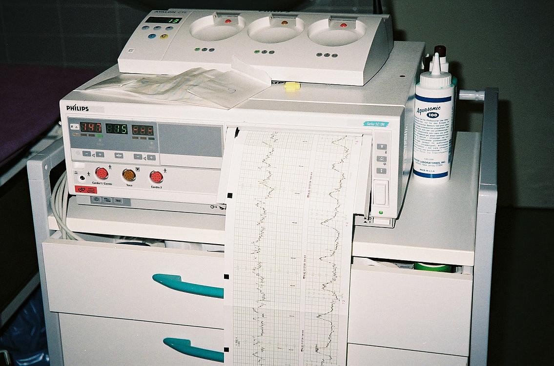 Cardiotocography Data Set - Fetal state classification — Part 1