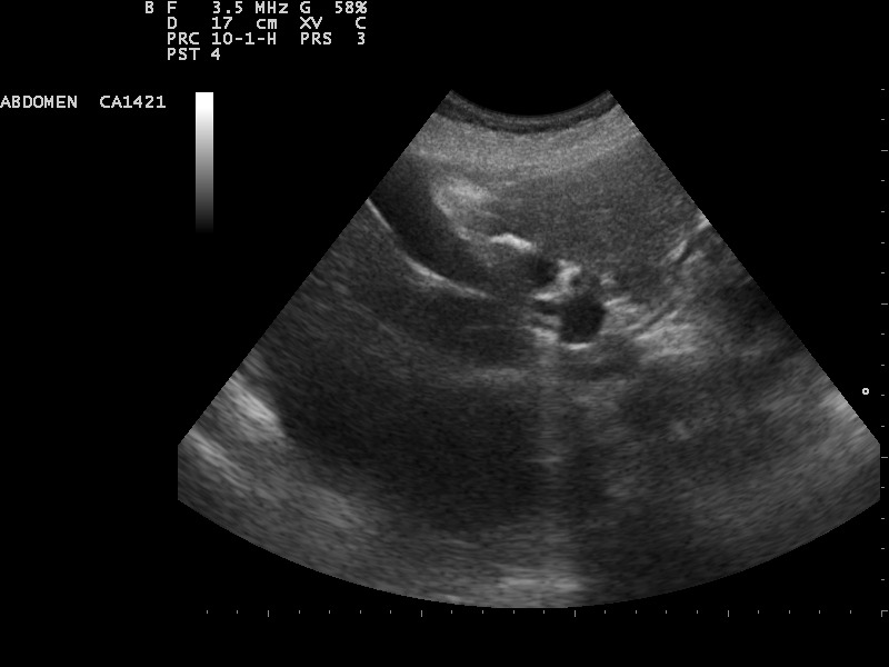 File:Ultrasound Scan ND 0112092239 0942590.png