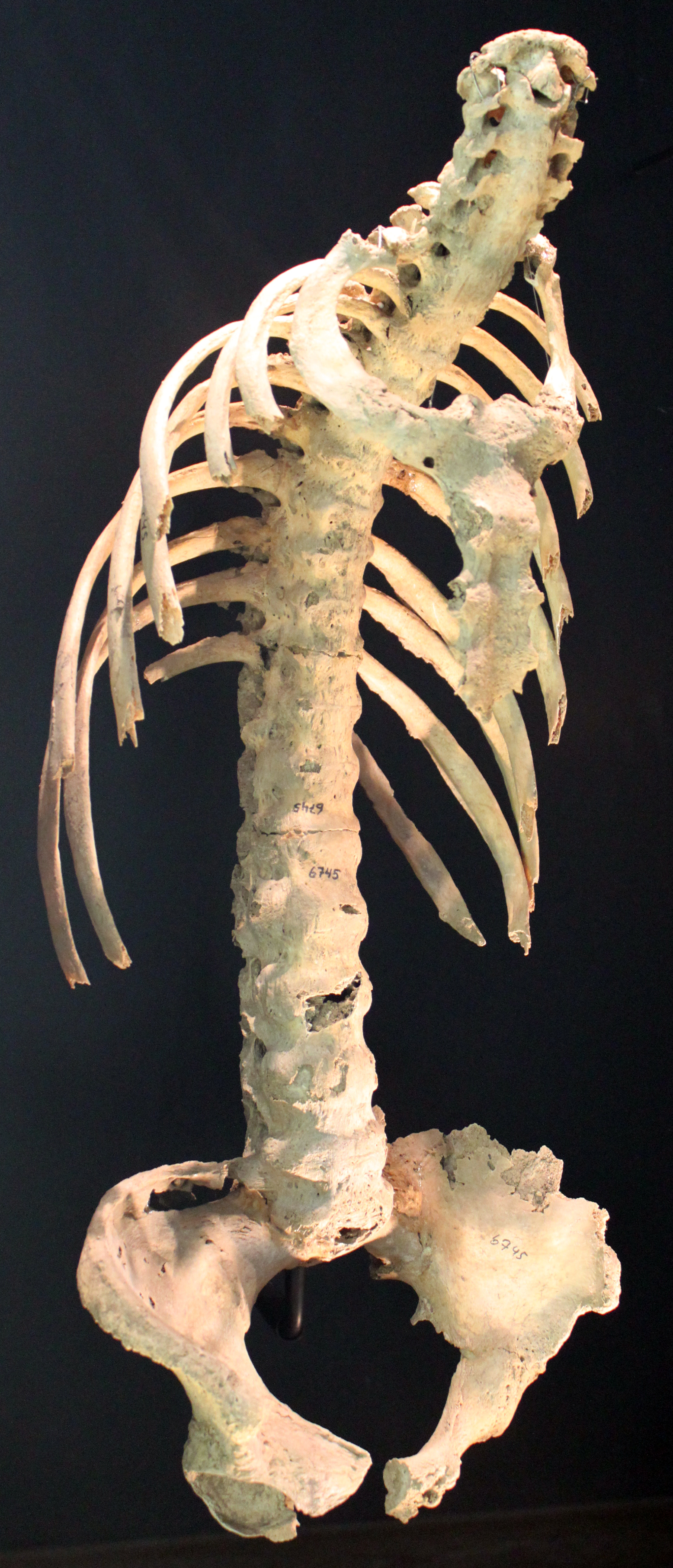 https://upload.wikimedia.org/wikipedia/commons/a/a8/0510_Spondylitis_ankylosans_%28morbus_bechterew%29_anagoria.JPG