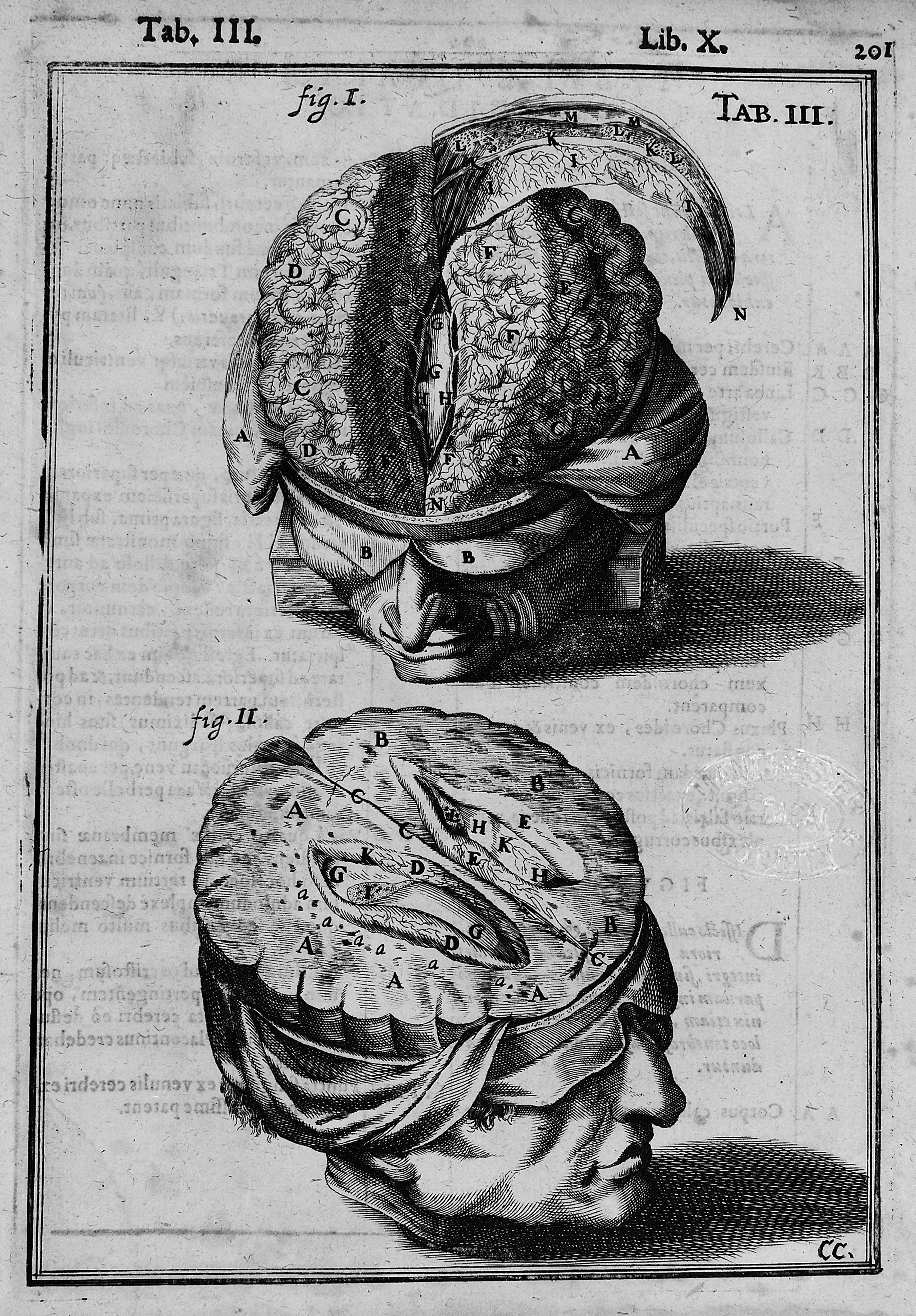 Пластина мозга. Observationes anatomicae. Венеция, 1587..