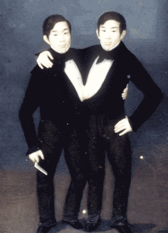 Chang and Eng Bunker, born in Siam (now Thailand) in 1811, were the origin of the term "Siamese twins".