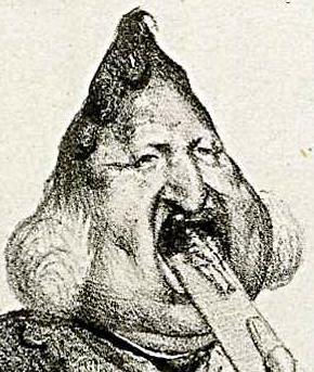 3 Honoré Daumier's Louis-Philippe as Gargantua, published in la