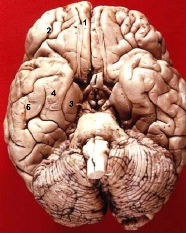 File:Human brain inferior view description 2.JPG