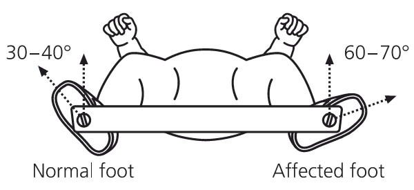 Normal feet. Brace position Авиация. Brace position.