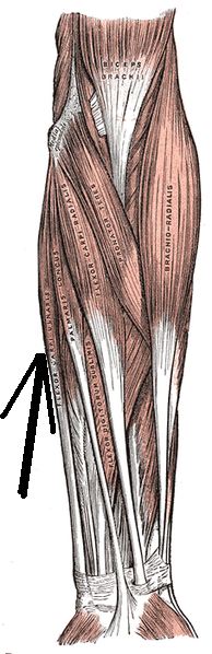 File:Musculusflexorcarpiulnaris.png