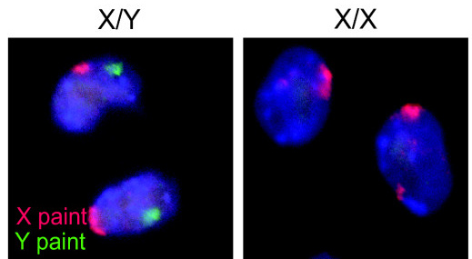 File:Mice X Y chromosomes.jpg