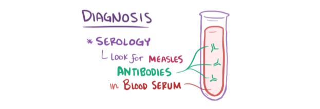 Image 12 of measles video