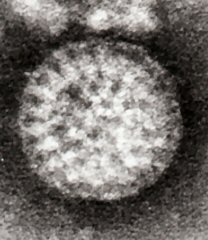 An electron micrograph of a single rotavirus particle; it is round and looks like a wheel