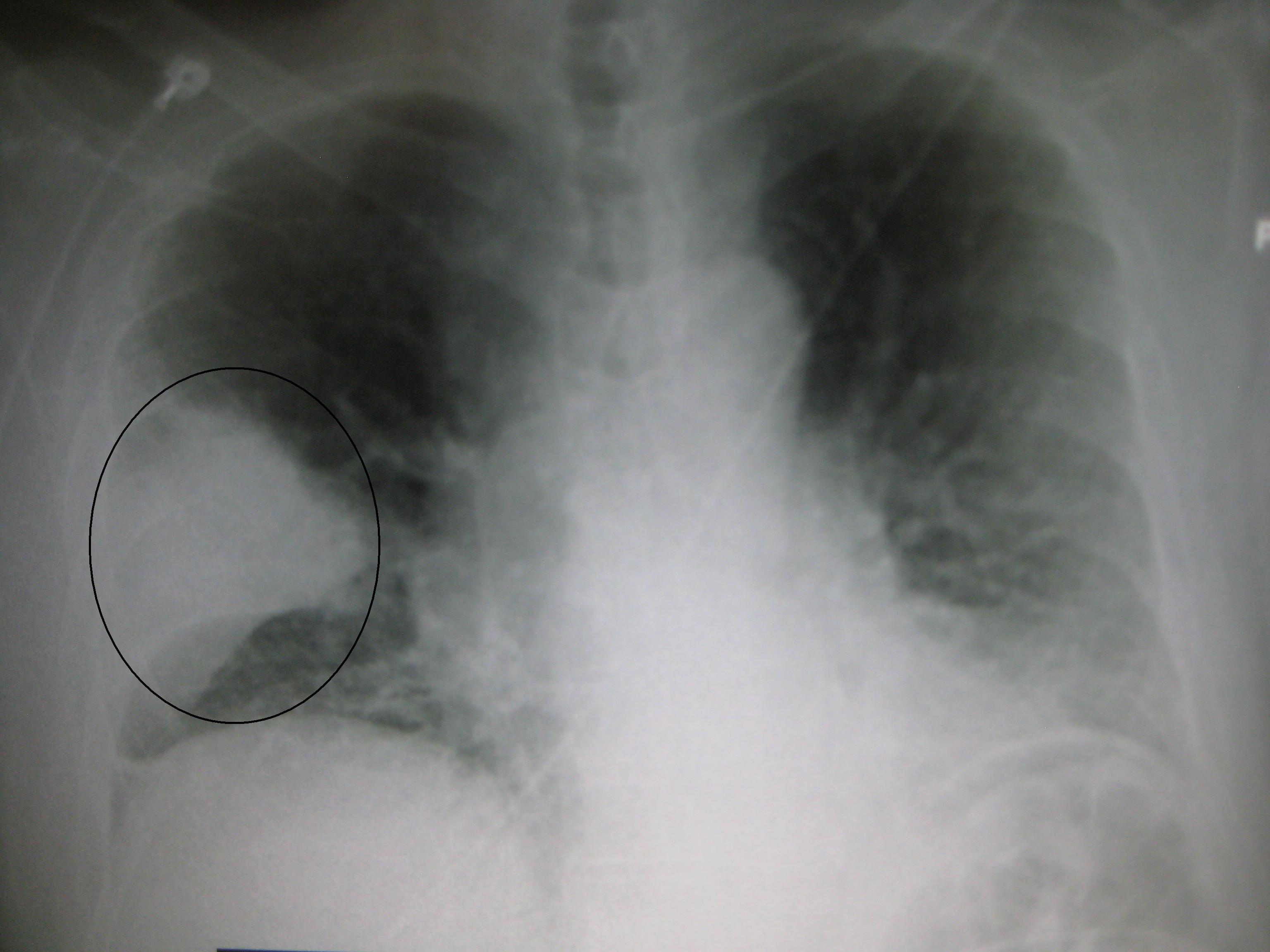 Chest - Tradução em português, significado, sinônimos, antônimos