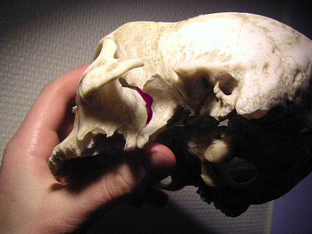 File:Pterygopalatine fossa.PNG