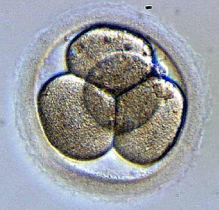 Эмбрион человека на 2—е сутки развития, визуализируются 4 бластомера. Автор: NinaSes. Вклад автора (серия фотографий).
