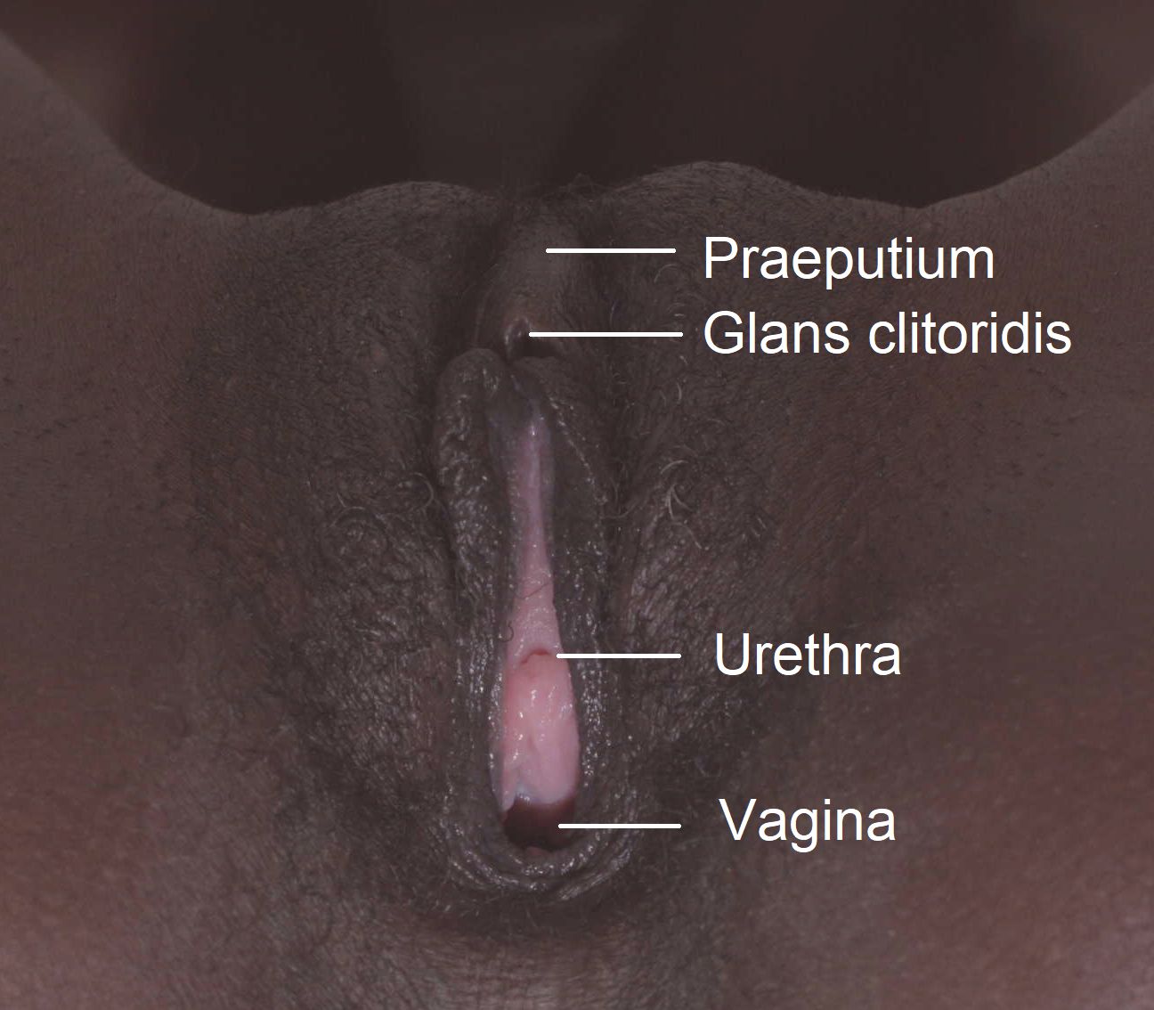 File:Vulva A.jpg - Wikimedia Commons
