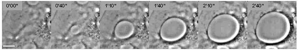 Figure 1. Snapshot images taken from a video showing the nucleation and growth of a TEM in an endothelial cell intoxicated with C3 exoenzyme from Clostridium botulinum for 24 hours, Bar = 10 mm. For the dynamics see Video. Cellular Dewetting.jpg