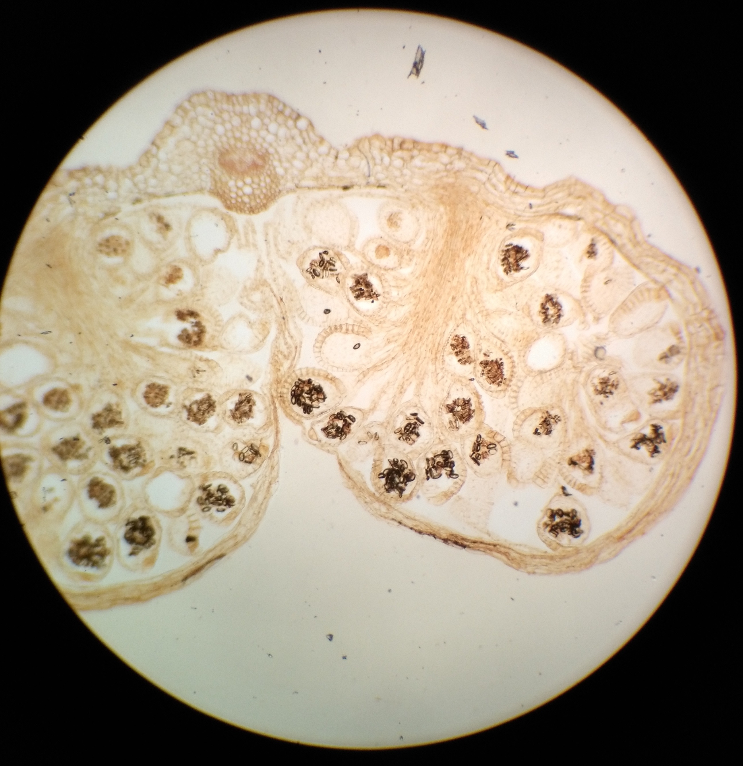 Препарат Сорус папоротника под микроскопом