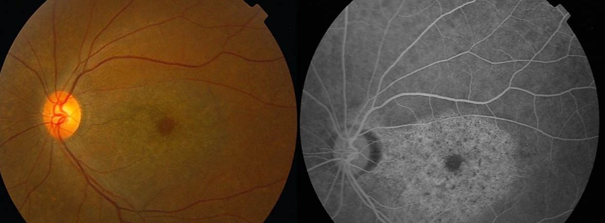 Retina - Wikipedia