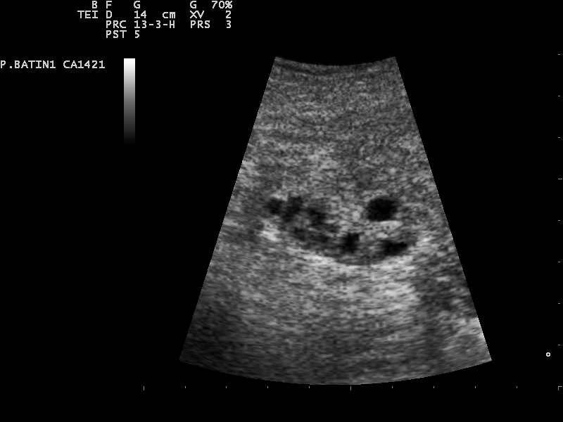 File:Ultrasound Scan ND 0128134059 1346340.png