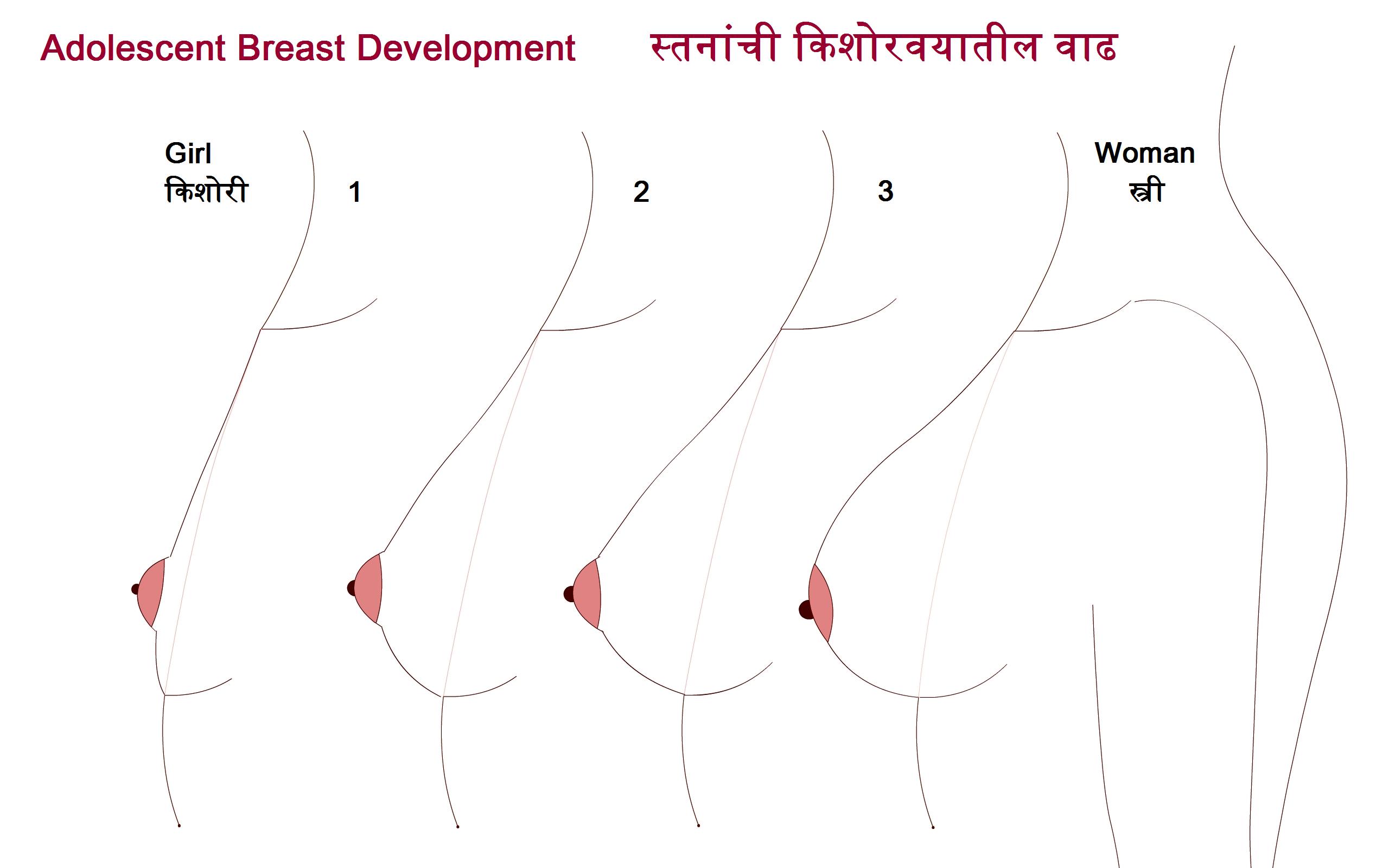 Disproportionate Breast Development in Teens - GirlSpring