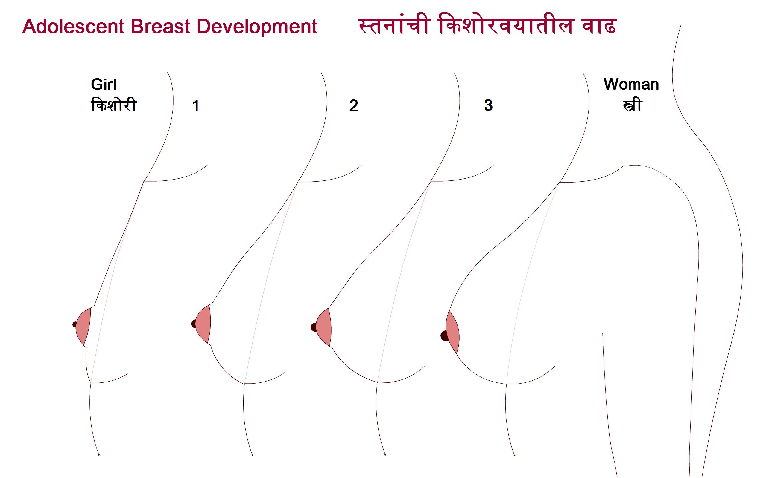 11 year old breast development