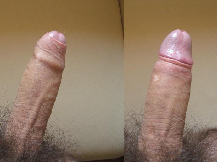 Uncircumcised human penis.