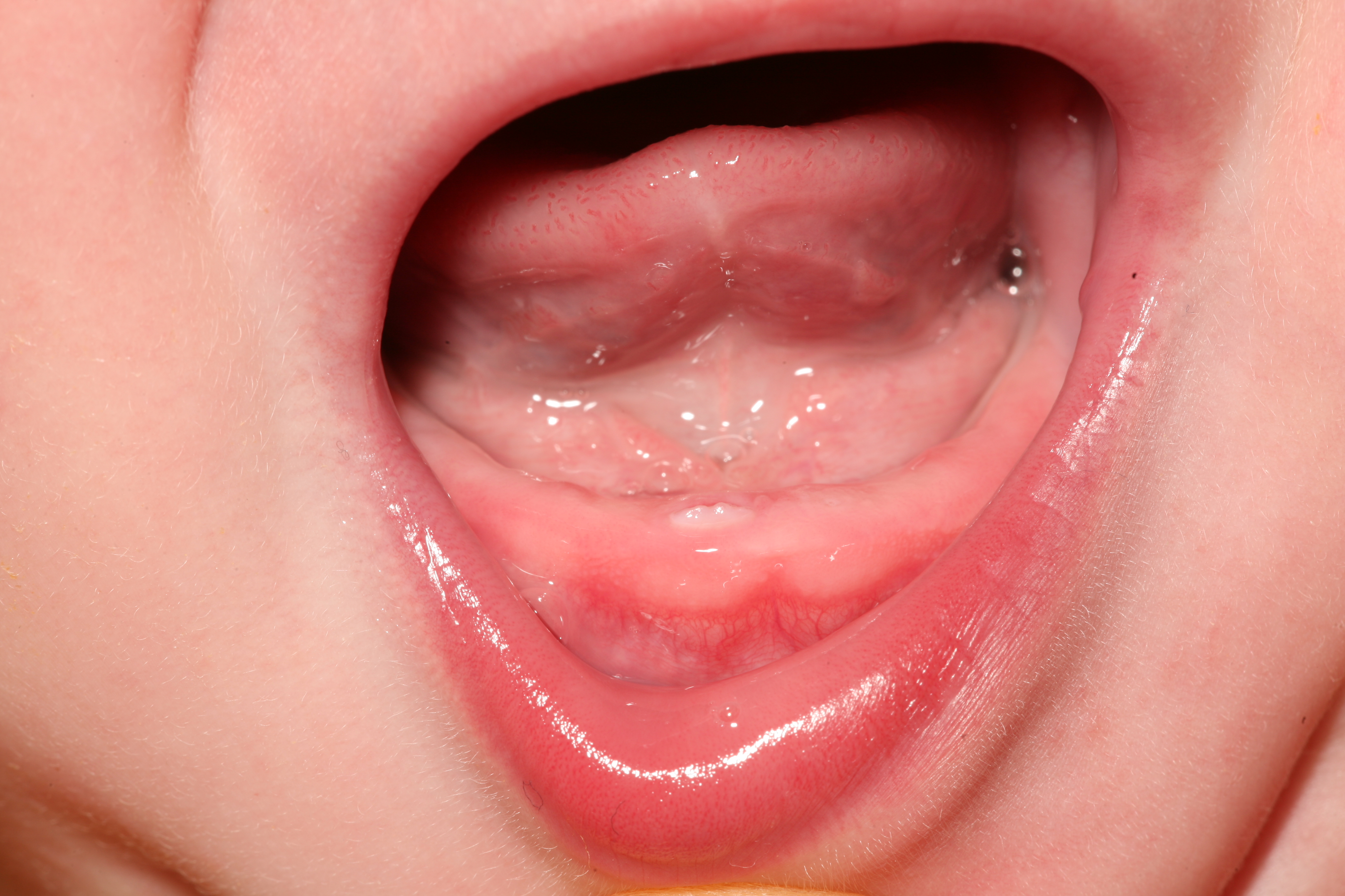 File Teething 2 jpg Wikipedia