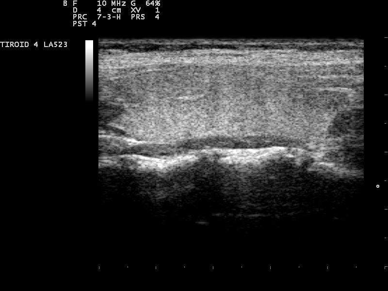 File:Ultrasound Scan ND 110218111651 1120131.jpg