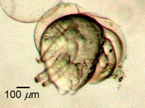 A pseudometanauplius of the krill species Nematoscelis difficilis hatches using the push-off hatching technique Metanauplius hatching.jpg