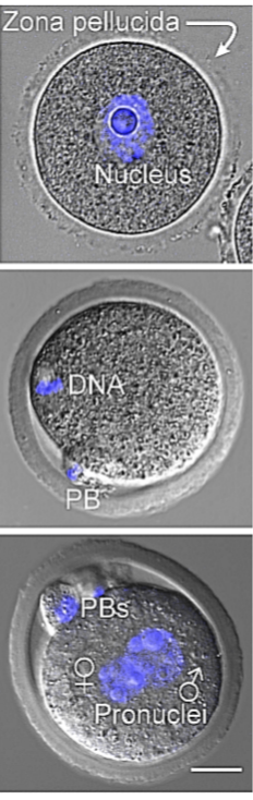 Ovulation - Wikipedia