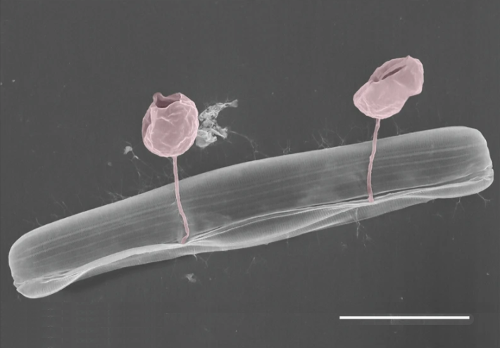 Pennate diatom from an Arctic meltpond, infected with two chytrid-like [zoo-]sporangium fungal pathogens (in false-colour red). Scale bar = 10 μm.[41]