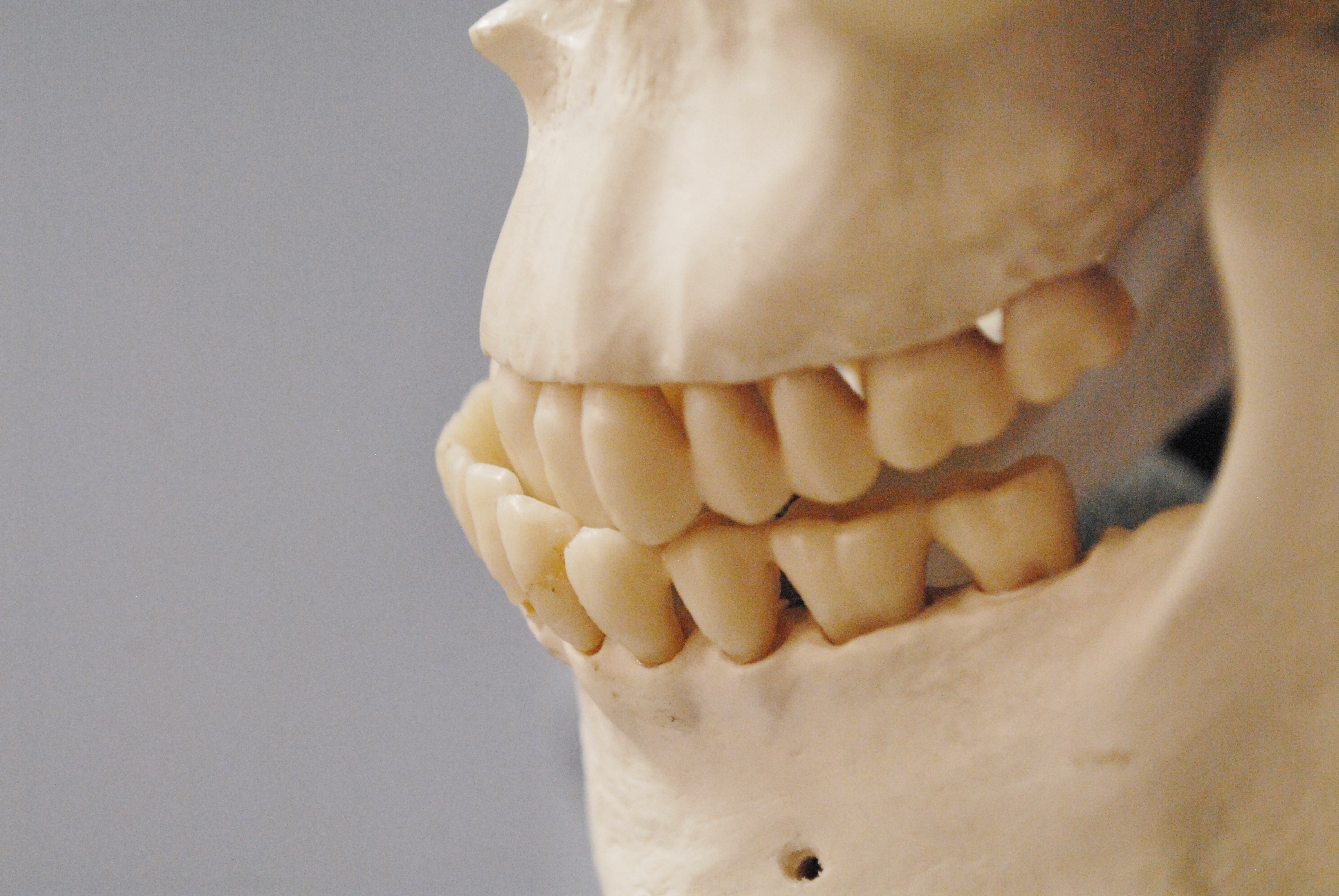 File:Skeleton with misaligned teeth.jpg - Wikimedia Commons