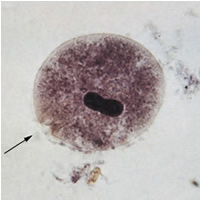 File:Balantidium trophB.JPG