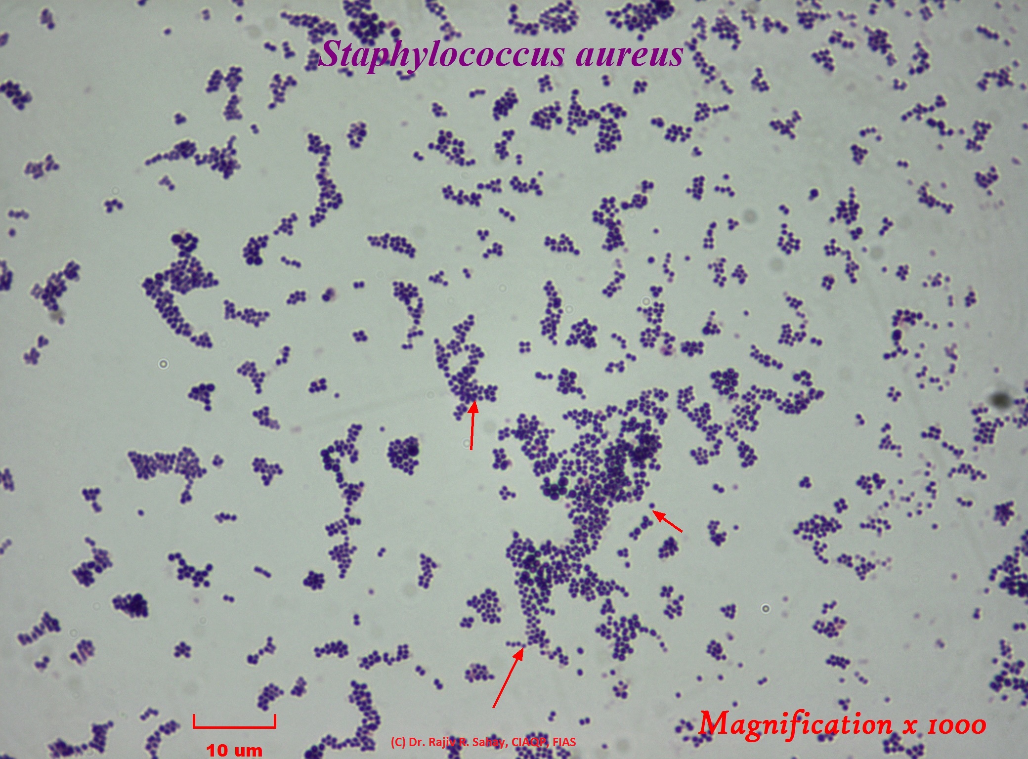 File:Staphylococcus aureus Gram stain.jpg - Wikimedia Commons