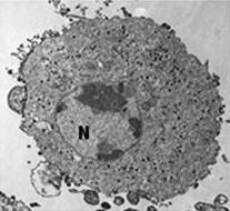 FV3-infizierte Zelle, die Virionen sind über das Zytoplasma verteilt