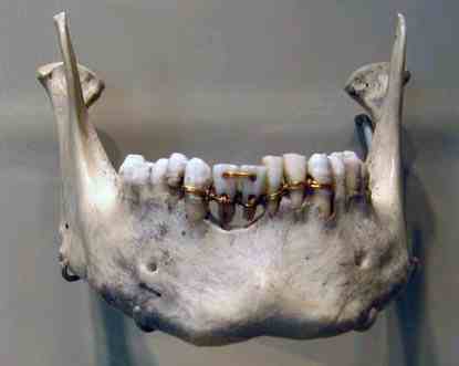 File:Ancient Egypt Dentistry2.jpg