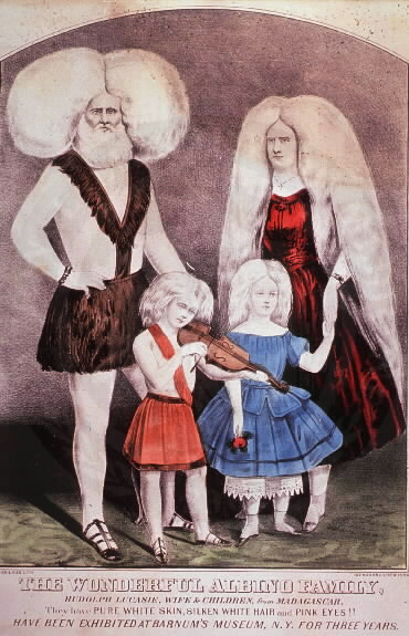 File:Albino Family.jpg