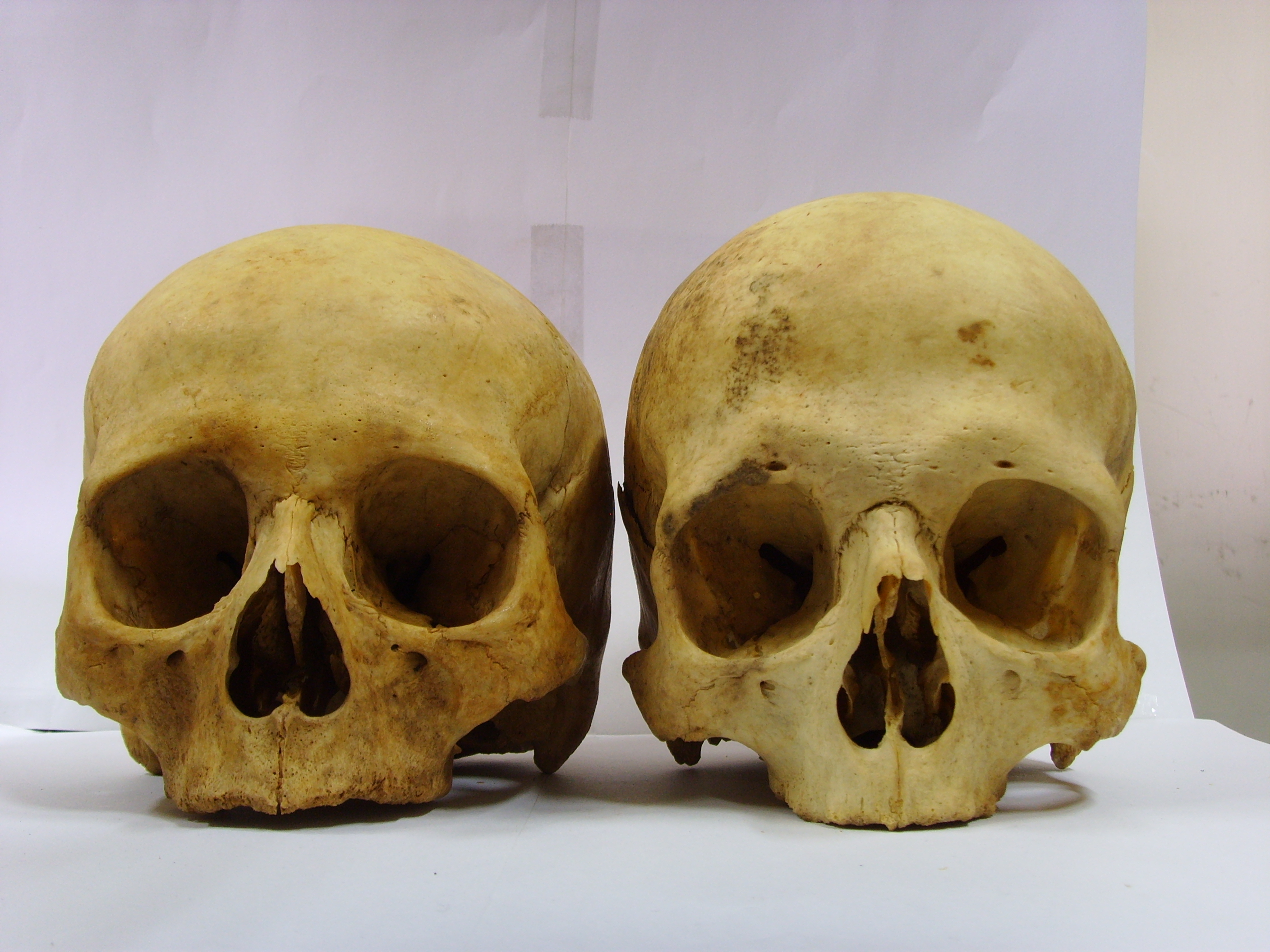 skull male vs female