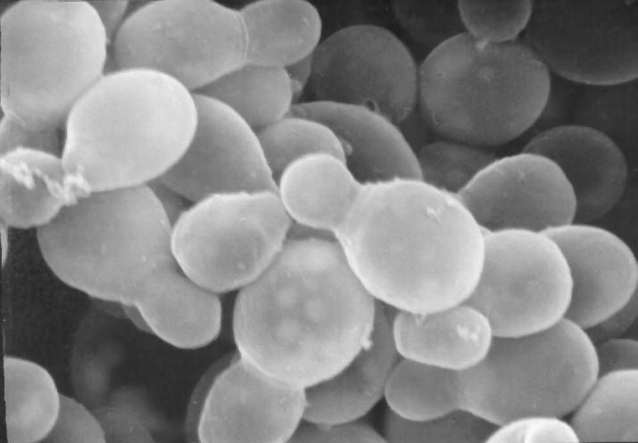 Sthanu on X: @AaronGoodman33 @sanamloghavi Tinea Versicolor Pityrosporum  (M. furfur) Pityrosporum ovale (oval) and Pityrosporum orbiculare (round).   / X