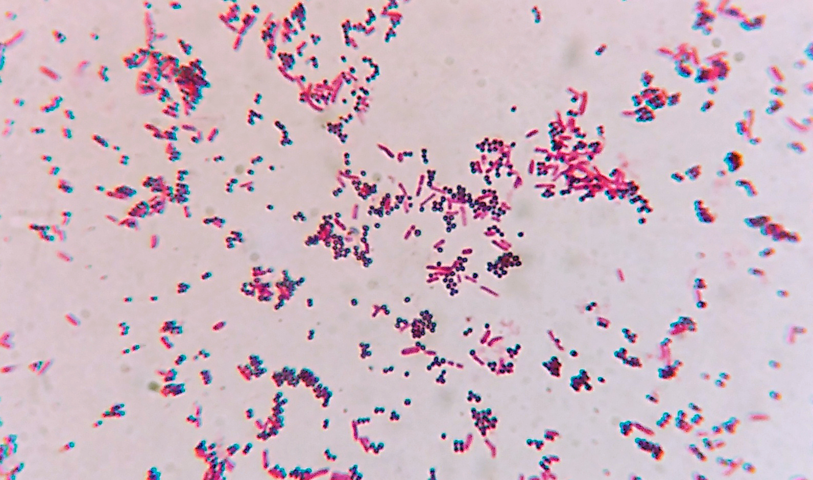 gram positive vs gram negative