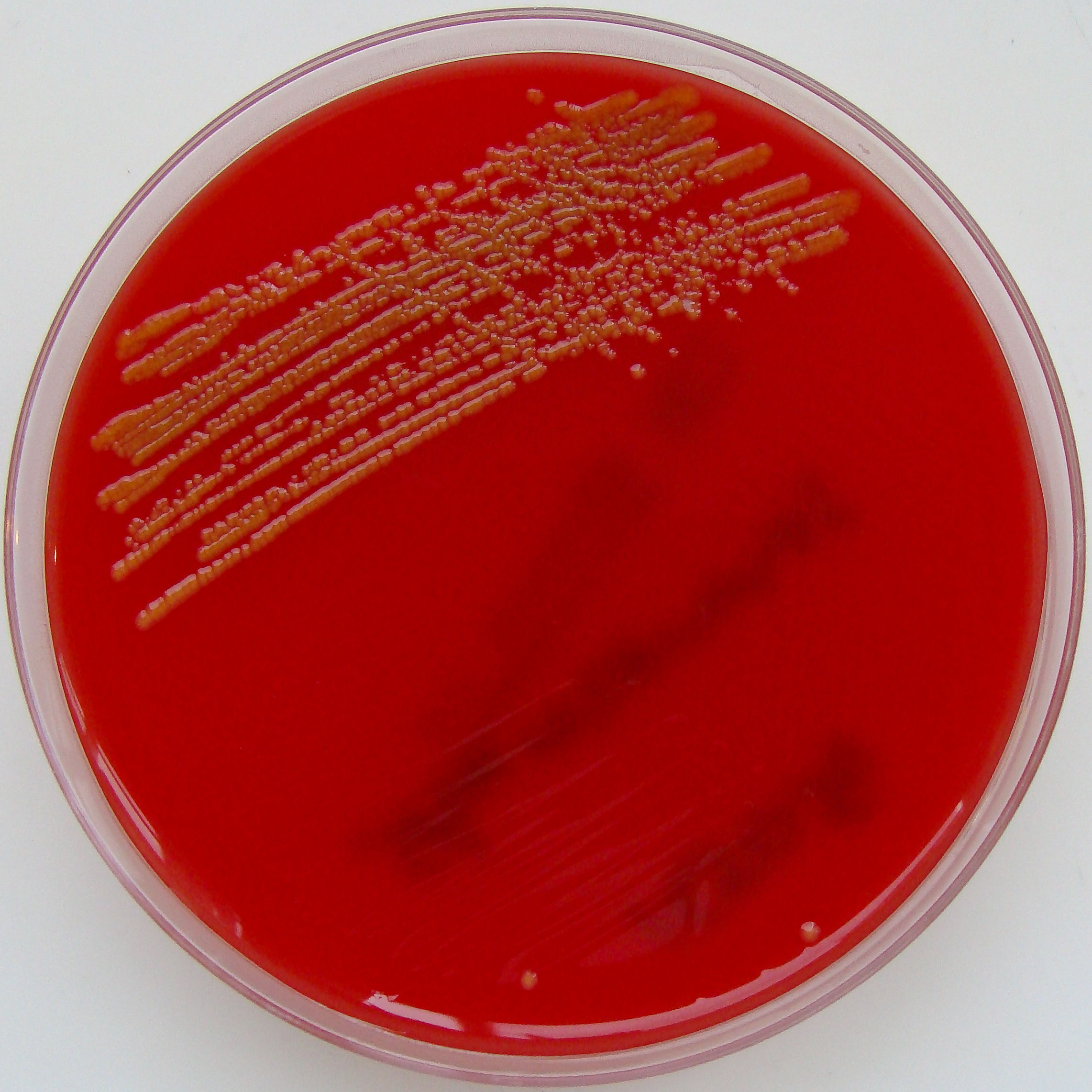 Staphylococcus aureus среда. Стрептококки на кровяном агаре микробиология. Стрептококки на кровяном агаре. ЖСА на кровяном агаре. Среда кровяной агар микробиология.