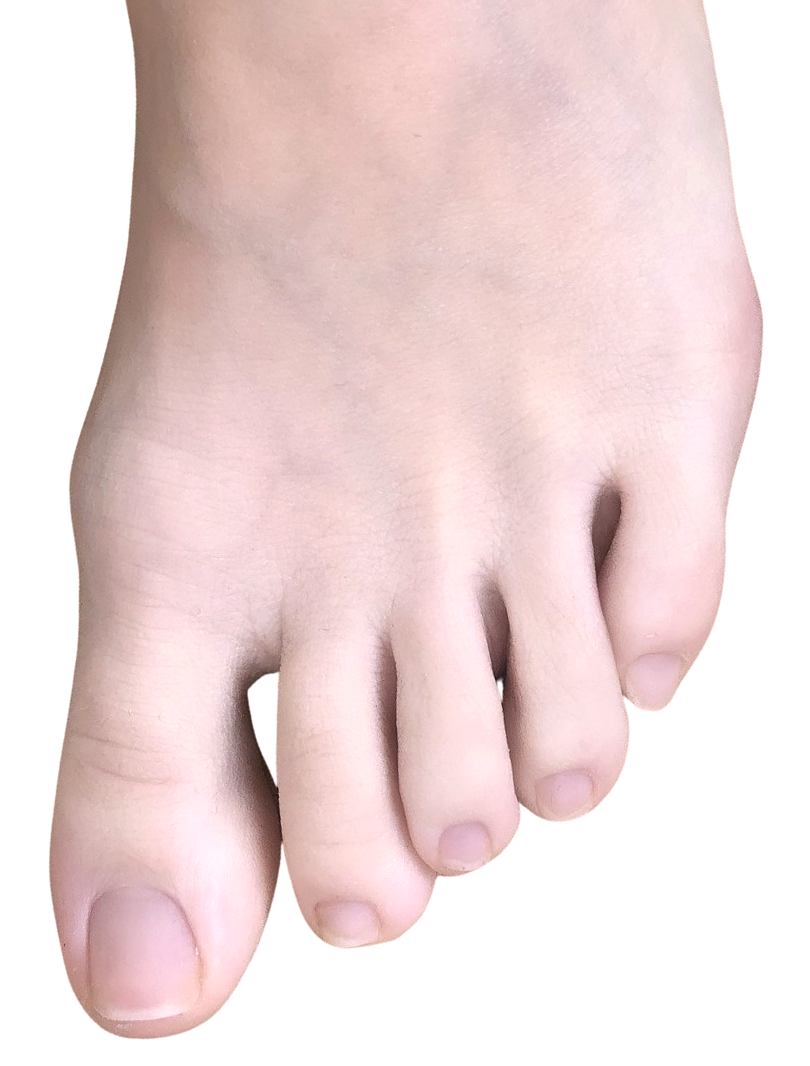 Cómo se llaman los dedos del pie: nombres de partes del cuerpo humano que no conocías