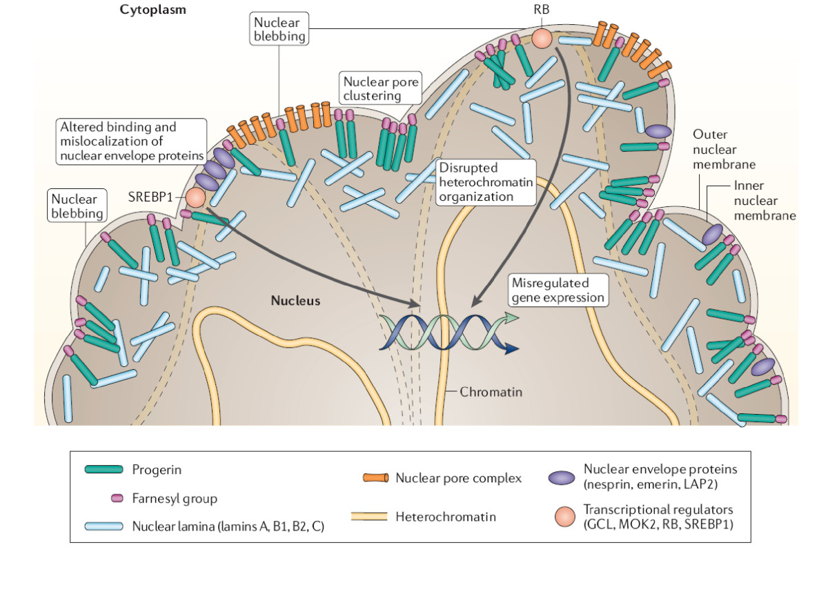 Cockayne Syndrome: Most Up-to-Date Encyclopedia, News & Reviews