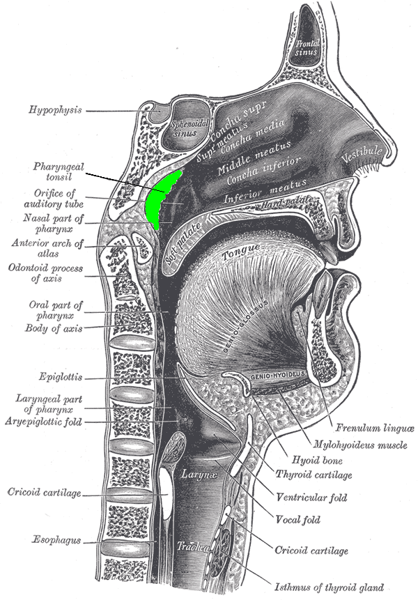 In anatomy, the pharyngeal tonsil, also known as the nasopharyngeal tonsil or adenoid, is the superior-most of the tonsils. It is a mass of lymphatic tissue located behind the nasal cavity, in the roof of the nasopharynx, where the nose blends into the throat. In children, it normally forms a soft mound in the roof and back wall of the nasopharynx, just above and behind the uvula.
The term adenoid is also used to represent adenoid hypertrophy, the abnormal growth of the pharyngeal tonsils.